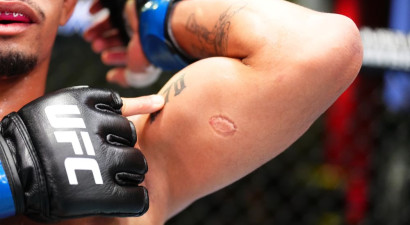 UFC par pretinieka sakošanu jau pēc pirmās cīņas izmet brazīliešu cīkstoni